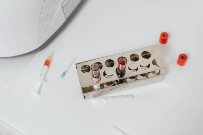 At-Home Hair Loss Tests: What the Kits Won't Tell You—and What Dermatologists Actually Order